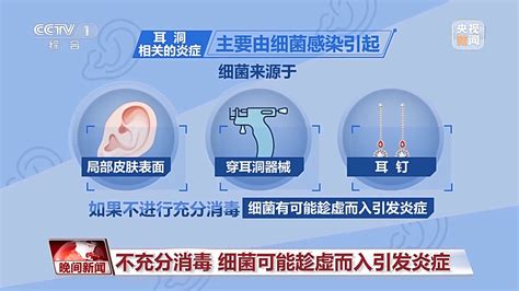 打耳洞 注意事項